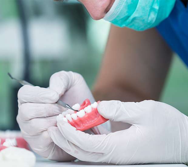 Boca Raton Partial Dentures for Back Teeth