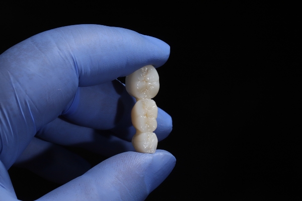 Porcelain Vs  Metal Dental Crowns: Which One Is Right For You?